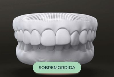 mordida-oralfy-catanduva-dentista-1.jpg