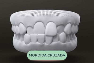 mordida-oralfy-catanduva-dentista-2.jpg