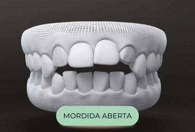 mordida-oralfy-catanduva-dentista-5.jpg