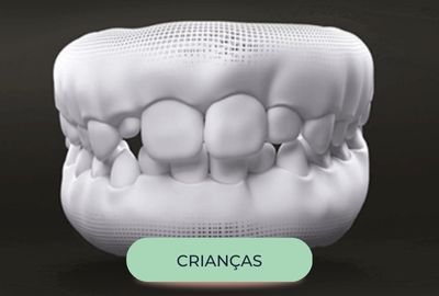 mordida-oralfy-catanduva-dentista-8.jpg